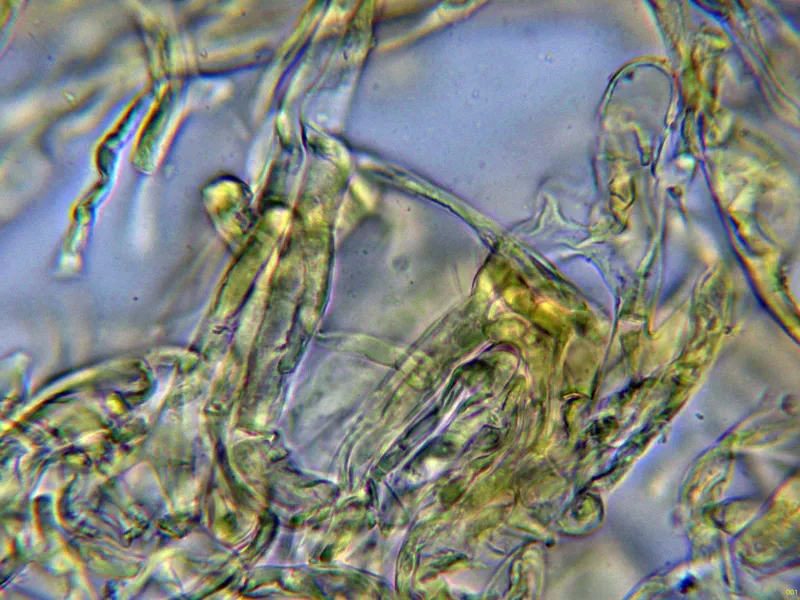Agaricus crocodilinus 10 - Suprapellis agua-001